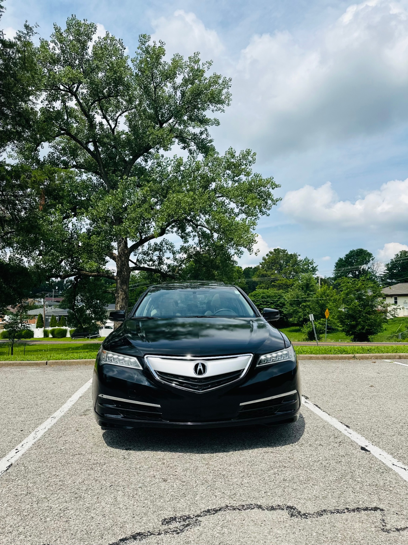 2015 Acura TLX – view 1